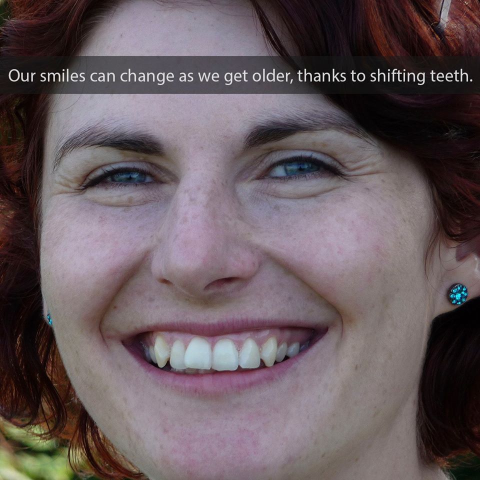 Our Smiles Can Change As We Get Older, Thanks To Shifting Teeth!