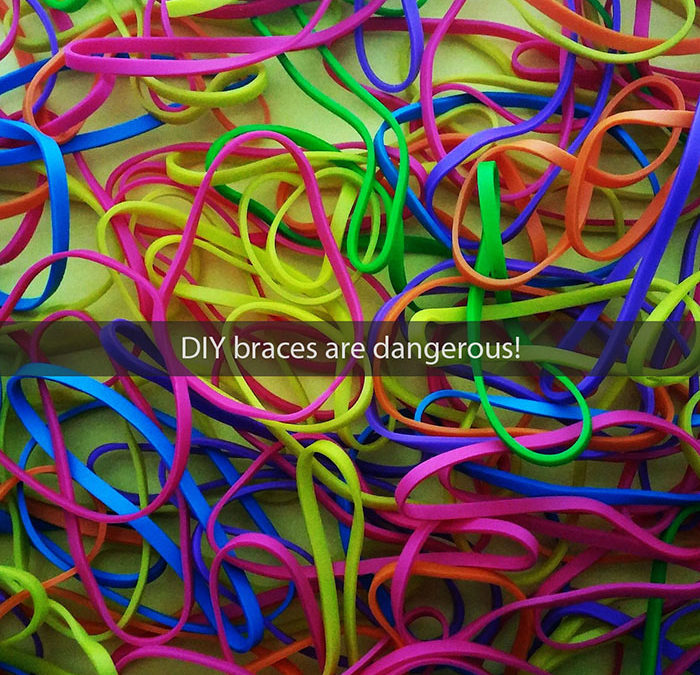 DIY Braces Are Dangerous