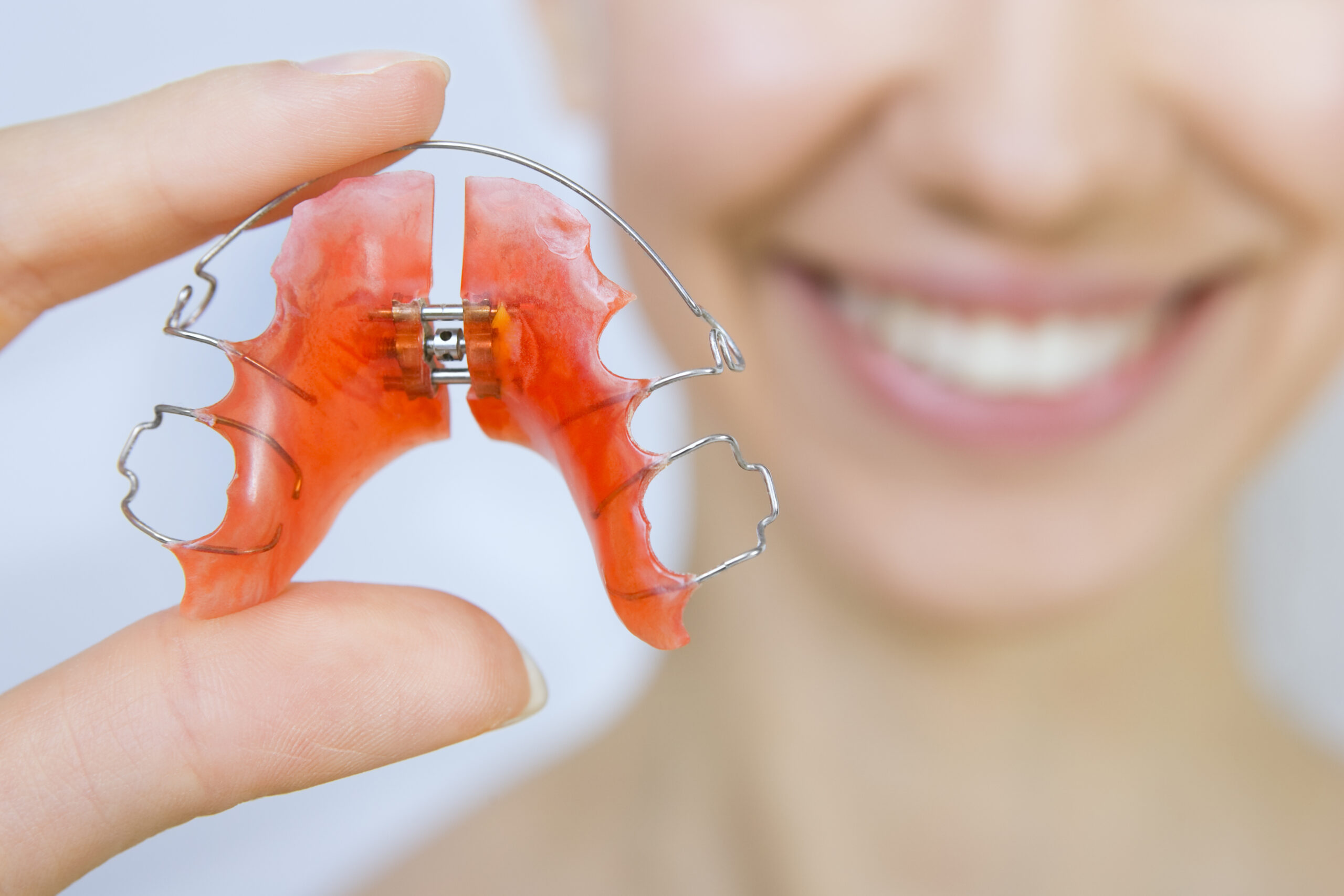 How Do Braces Fix An Overbite