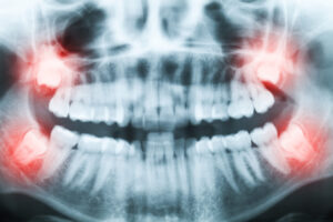 Find an Orthodontist, Orthodontist near me, orthodontist