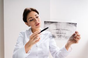 How Long Do You Have to Wear Invisalign?