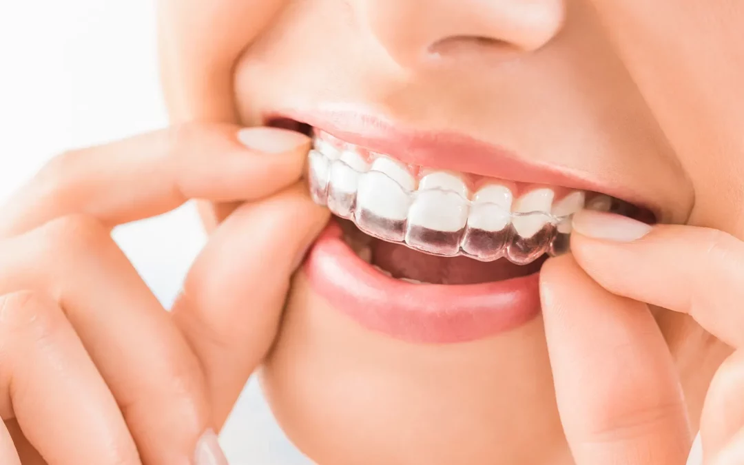 Signs You Might Need Orthodontic Treatment