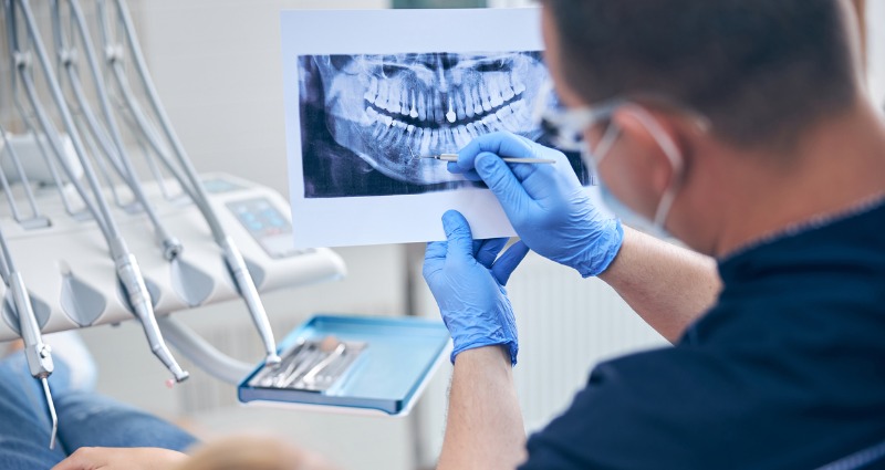 What is Accelerated Orthodontics?
