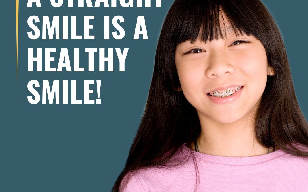 The Surprising Benefits of a Straight Smile: More Than Just Aesthetics!