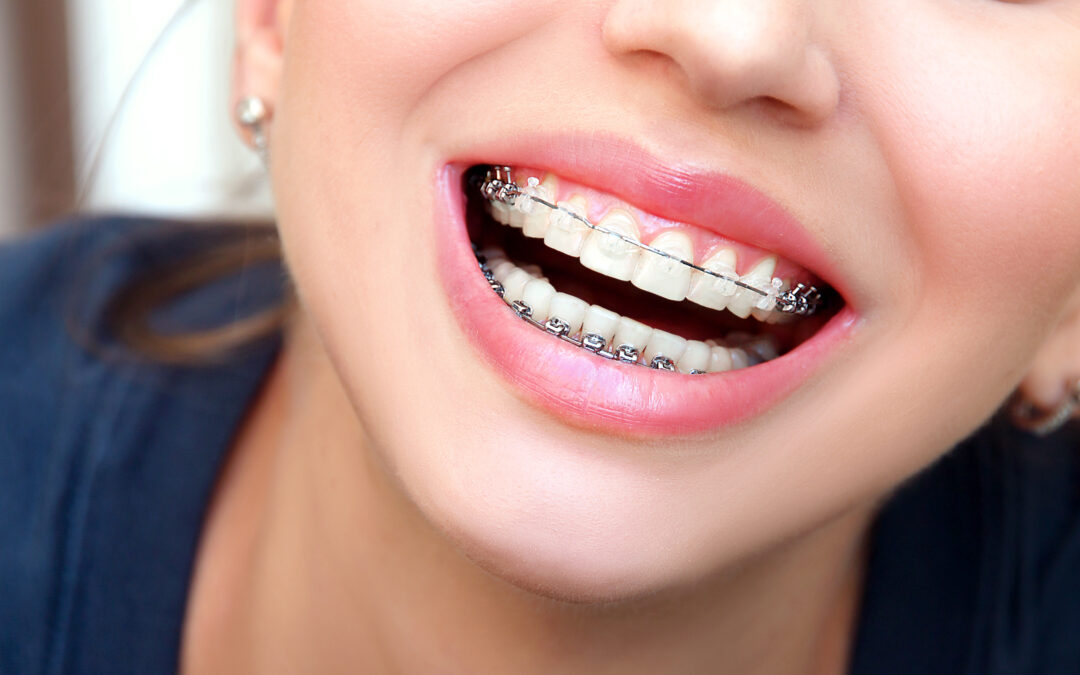 Cutting-Edge Advancements in Orthodontic Technology and Techniques