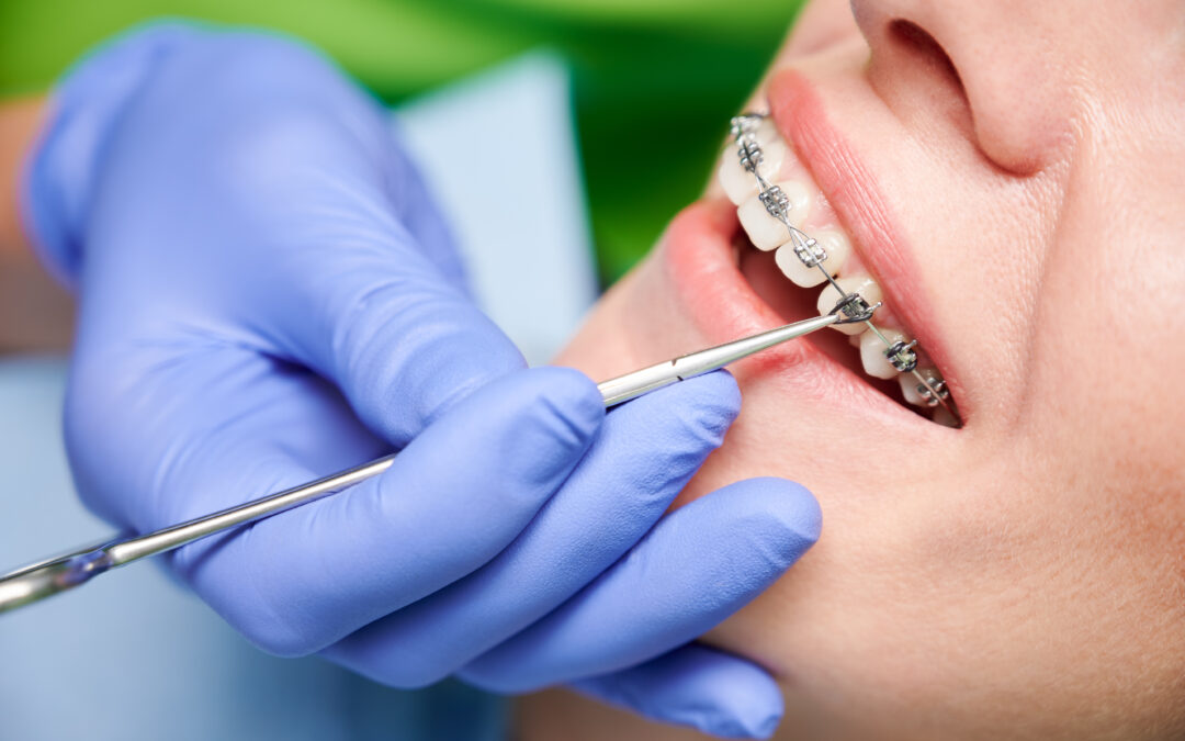 How to Choose the Right Orthodontist
